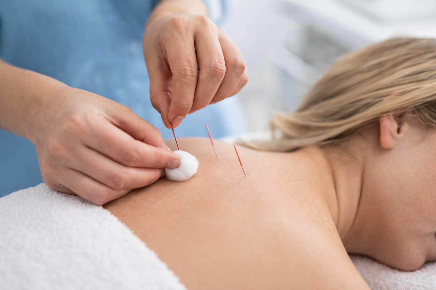 Algodão em bola Alba - 100 unidades