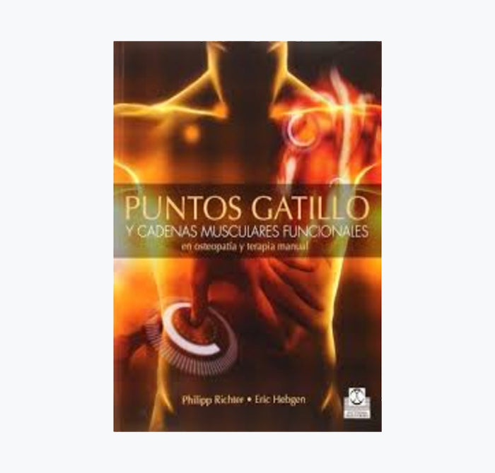Puntos Gatillo