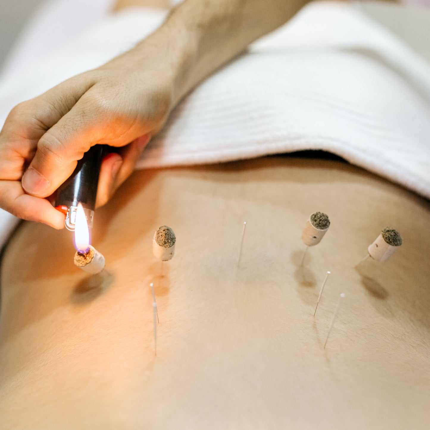 Moxa Cortada p/a agulha quente