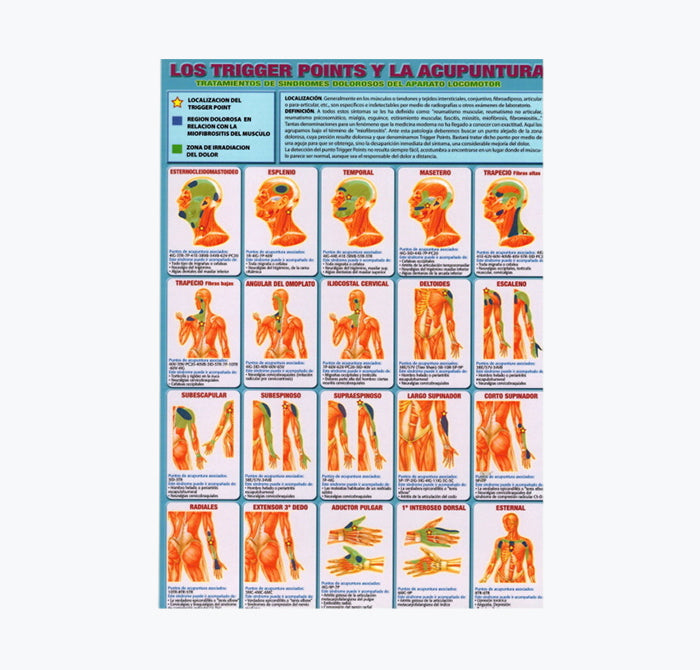 Mapa "Los Trigger Points y La Acupuntura", 30x21 cm